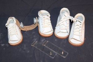 lot 462 image: Vintage Corrective Baby Shoes