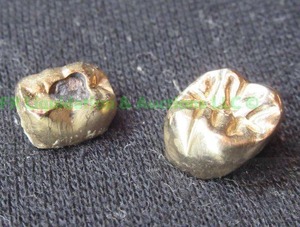 lot 193 image: Solid Gold tooth fillings, adult molars